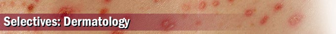 Selectives: Dermatology