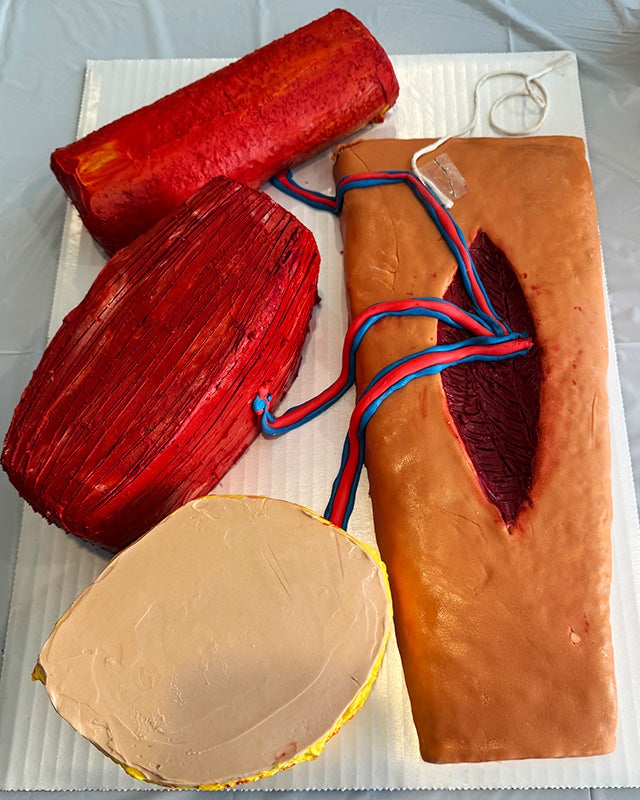 A cake consisting of four parts, each one designed to look like the different tissue layers of a free flap surgery procedure